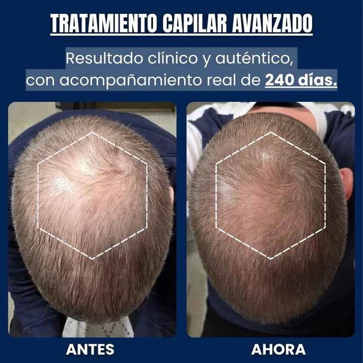 Sérum Capilar Péptidos de Cobre – Veralis Lab
